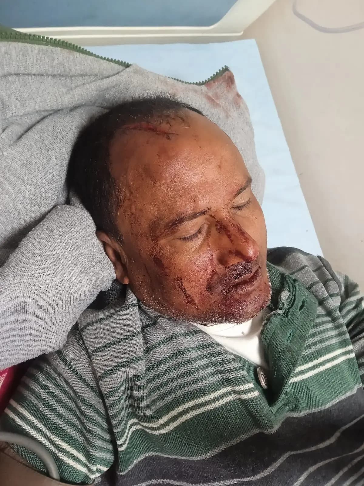 पुरानी रंजिश को लेकर दो पक्षों में हुई मारपीट