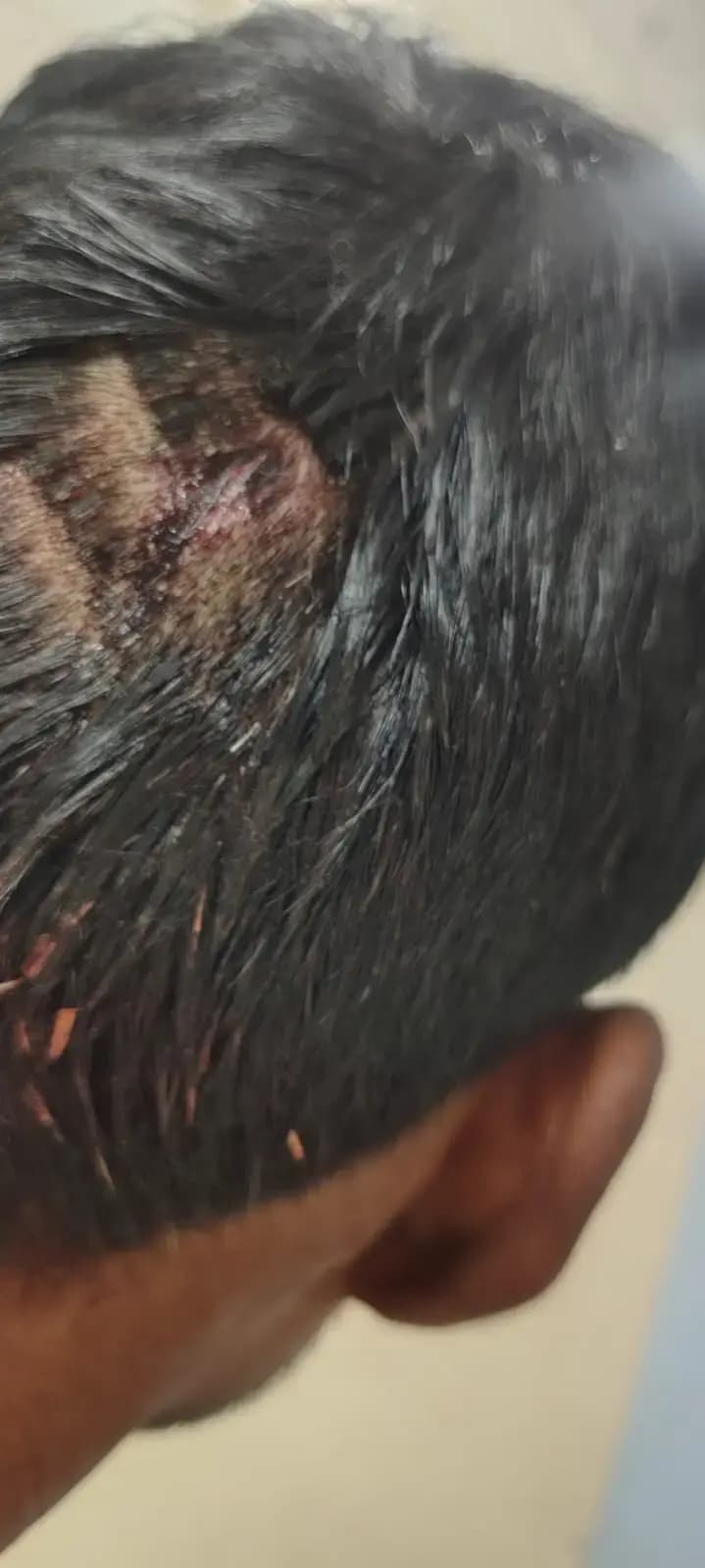 दबंगों ने पीट-पीटकर किया पति-पत्नी को लहुलुहान