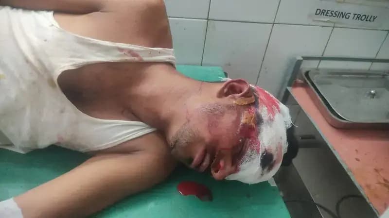 तेज रफ्तार बाइक डिवाइडर से टकराई, एक युवक की मौत, दूसरा गंभीर हालत में रेफर
