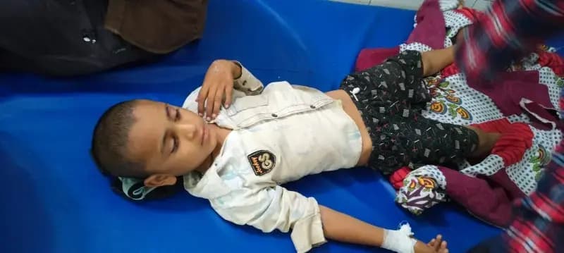 घर के आंगन में खेलते समय 6 वर्षीय बालक को सर्प ने काटा, सीएचसी दुद्धी में भर्ती