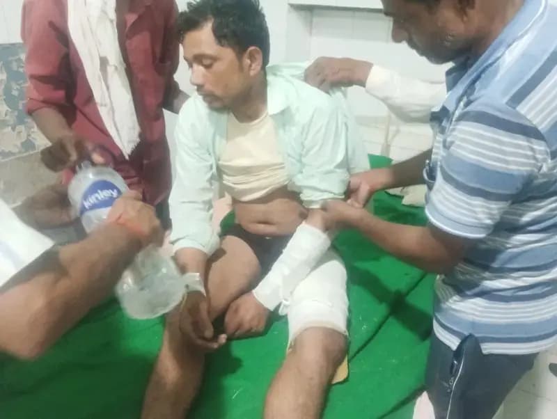 करंट लगने से खंभे से गिरा संविदा लाइनमैन, हाथ-पैर टूटा