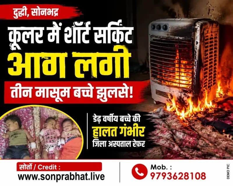 कूलर में शॉर्ट सर्किट से लगी आग, तीन मासूम झुलसे