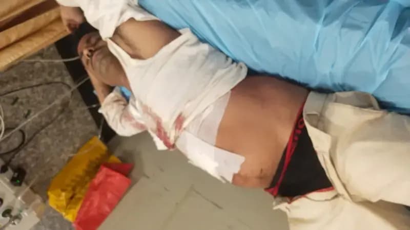 अज्ञात बदमाशों की ताबड़तोड़ फायरिंग से युवक गंभीर, ट्रामा सेंटर वाराणसी रेफर