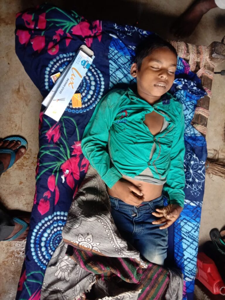 सर्पदंश से एक नाबालिग की मृत्यु।