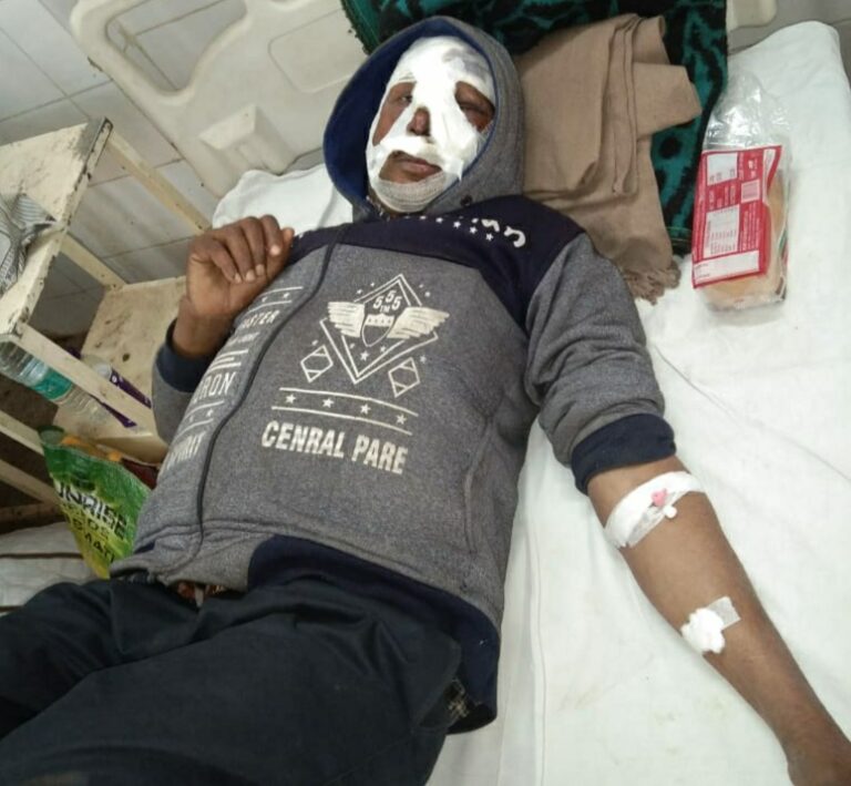 बाइक सवार वन कर्मी घायल,रेफर पैसे के अभाव मे इलाज अधूरा,2018 से बंद है वेतनमान।