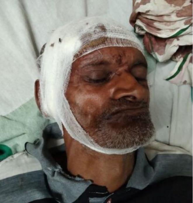 जमीनी विवाद को लेकर हुए मारपीट में महिला समेत कुल पांच लोग हुए घायल।