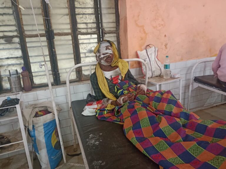 दुद्धी म्योरपुर मार्ग के जानलेवा गड्ढे की चपेट में आकर स्कूटी सवार गंभीर रूप से घायल।