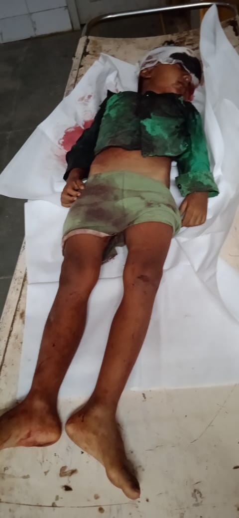 Sonbhadra News :ताजिया जुलूस के दौरान एसएचओ के वाहन की चपेट में आने से मासूम की मौत। 