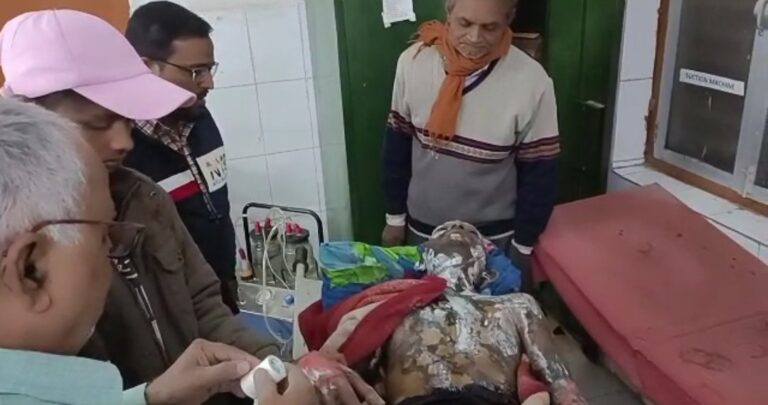 संदिग्ध परिस्थितियों में युवक ने खुद पर लगाई आग।