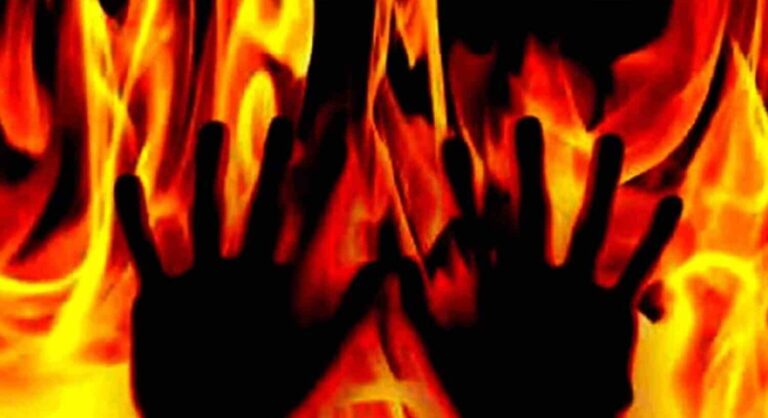 Breaking:-संदिग्ध परिस्थितियों में महिला कांस्टेबल ने लगाई आग, रेफर