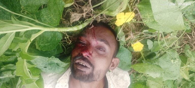 अपडेट:-खून से लथपथ मिला पूर्व प्रधान के भतीजे का शव,हत्या आसंका