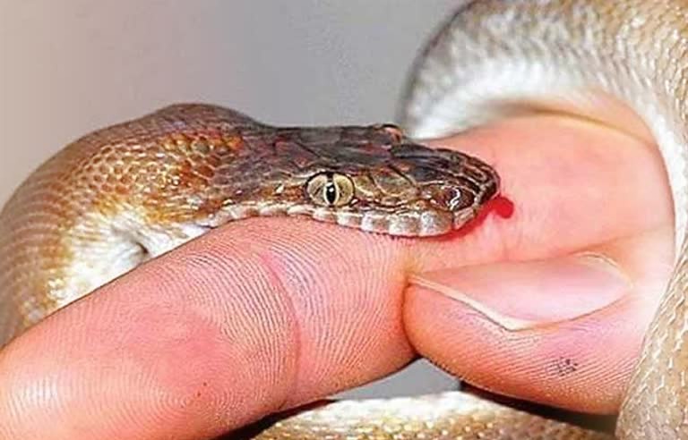 सर्पदंश से किशोरी की इलाज के दौरान मौत