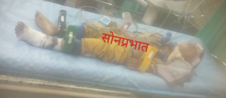 Accident-ट्रक के चपेट में आया मासूम,मौत