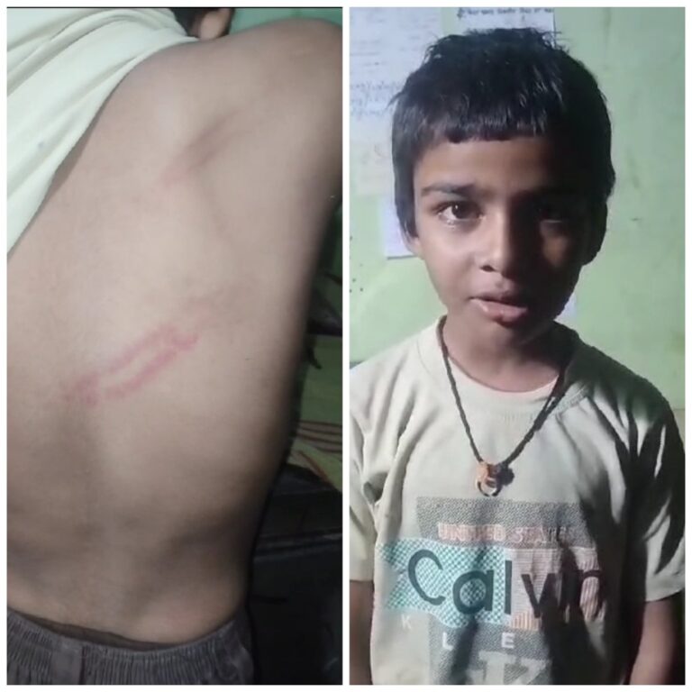 सोनभद्र : चौथी में पढ़ने वाले 9 वर्षीय छात्र को अध्यापक ने बेरहमी से पीटा,मामला पुलिस अधीक्षक तक।