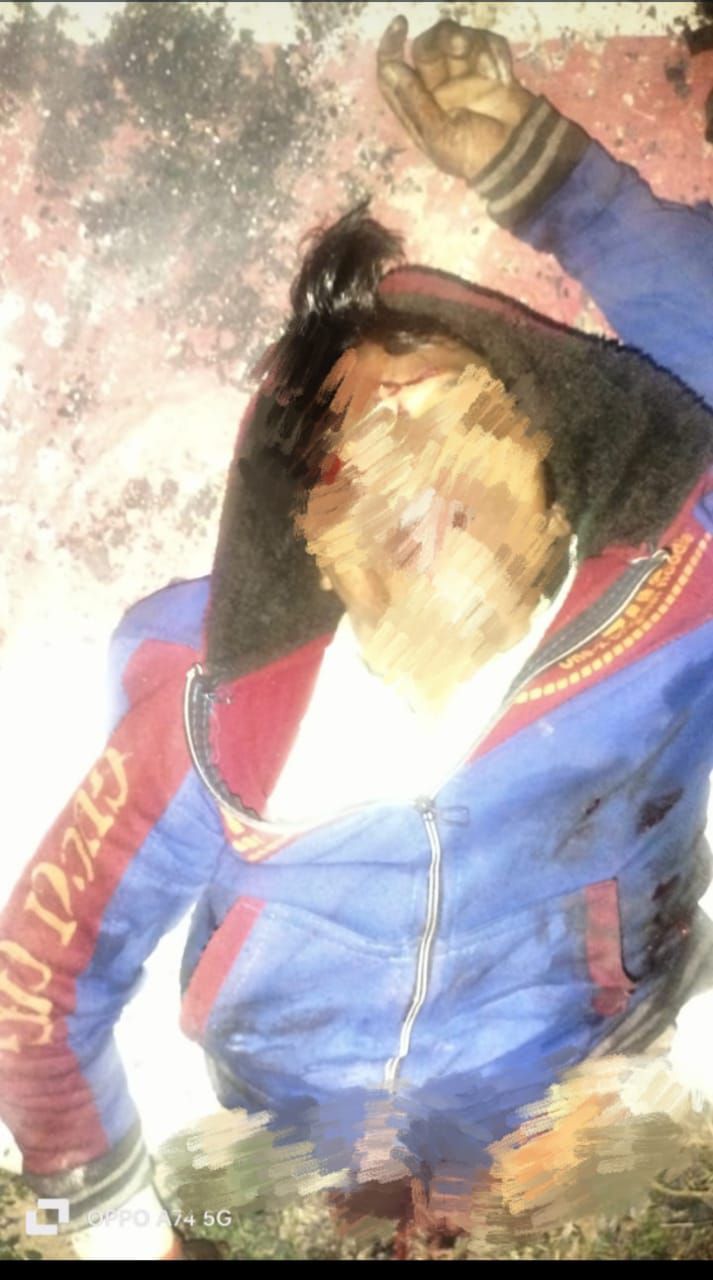 अज्ञात कारणों से 24 वर्षीय मृत व्यक्ति का शव रेलवे अंडर पास पर मिला।