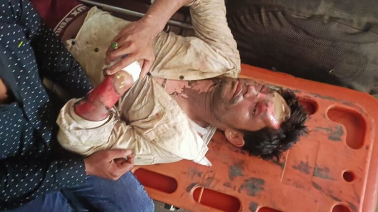 पेंटिंग के दौरान बिजली की चपेट में आने से युवक झुलसा