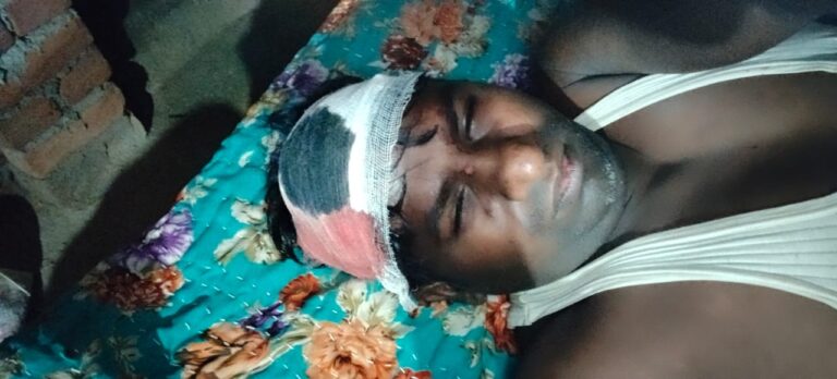 रोजगार सेवक पर नशे में धुत युवकों ने किया जानलेवा हमला, हालत गंभीर।