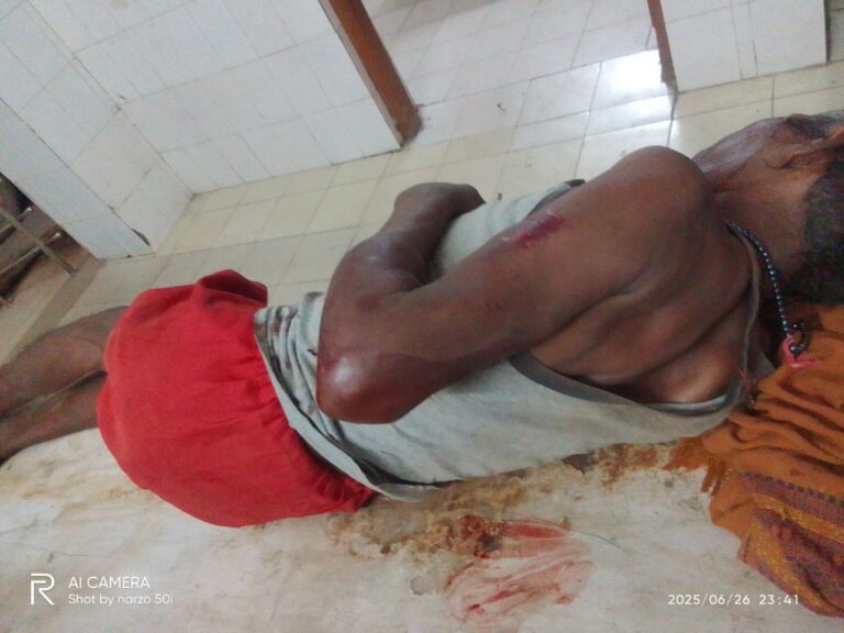 खुलेआम दबंगई नाबालिग की आबरू लूटने के लिए बुजुर्ग पर हमला,पीड़िता की मां के तहरीर पर एसपी ने दिए निर्देश, हुआ मुकदमा दर्ज।