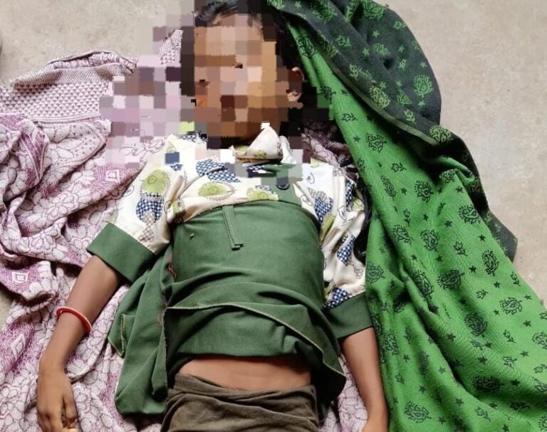 सोनभद्र: ग्राम चांचीकला में विषैले जंतु के डंक से 7 वर्षीय मासूम की मौत, जिले में लगातार बढ़ रहीं ऐसी घटनाएं.