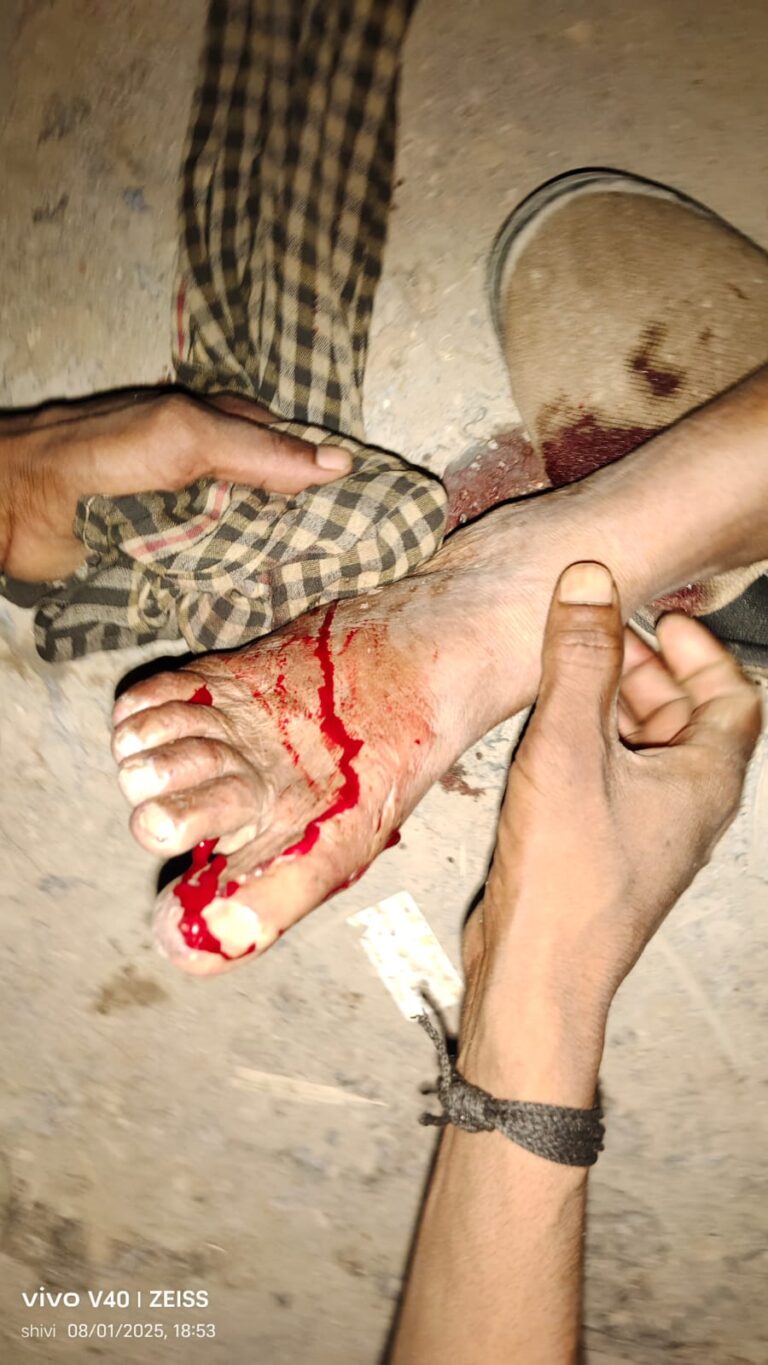 डाला सोनभद्र : ट्रक की चपेट में आए बुजुर्ग, गंभीर रूप से घायल – मचा हड़कंप