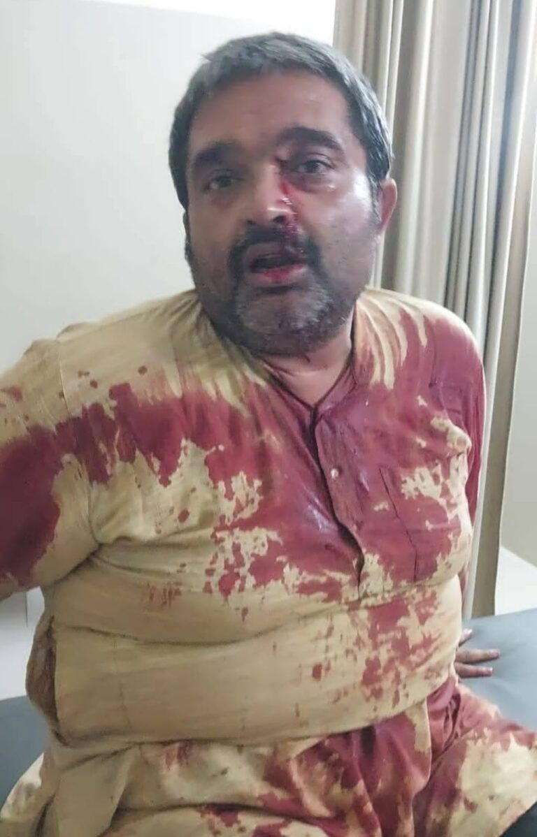 अधिवक्ता के साथ मार पीट करने वाले पुलिस अधिकारी को बर्खास्त कर कठोर करवाई करे सरकार–राकेश शरण मिश्र