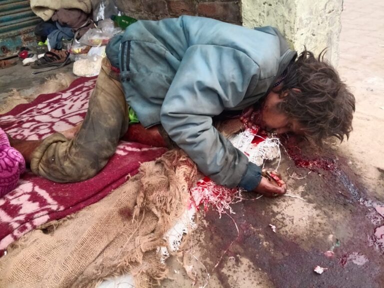 Sonbhadra Crime: खून से लथपथ मिला अर्धविक्षिप्त युवक की लाश, हत्या की आशंका