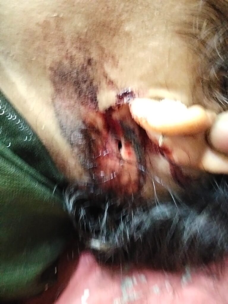 Sonbhadra Crime: नाबालिक लड़की से अवैध संबंध का विरोध करने पर लड़की को रेलवे लाइन की पटरी पर फेंका, रेफर