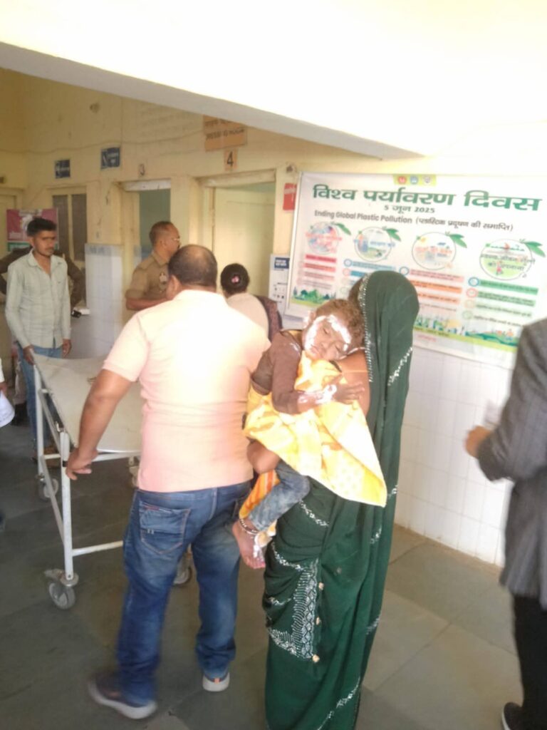 खाना बनाते समय गैस सिलेंडर लीकेज से लगी आग, दंपती और मासूम समेत चार लोग झुलसे