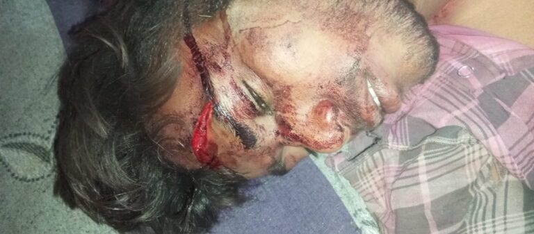 लाठी डंडे से युवक पर हमला, जांच में जुटी पुलिस