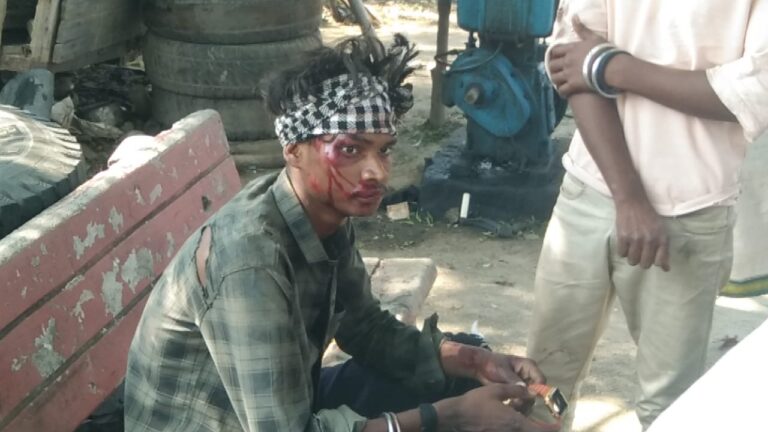 दो बाइक की आमने-सामने टक्कर में नाबालिक सहित चार घायल